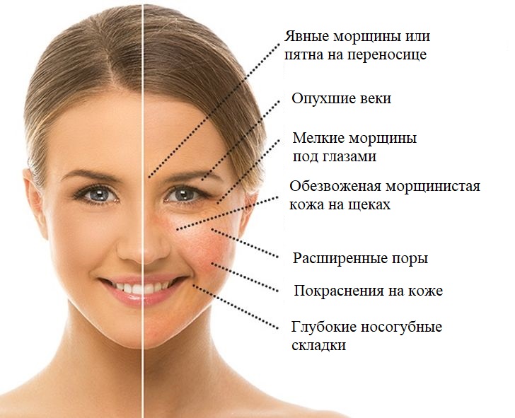 Как убрать покраснение и отёчность лица после приёма алкоголя? Как убрать покраснение и отёчность лица после приёма алкоголя?